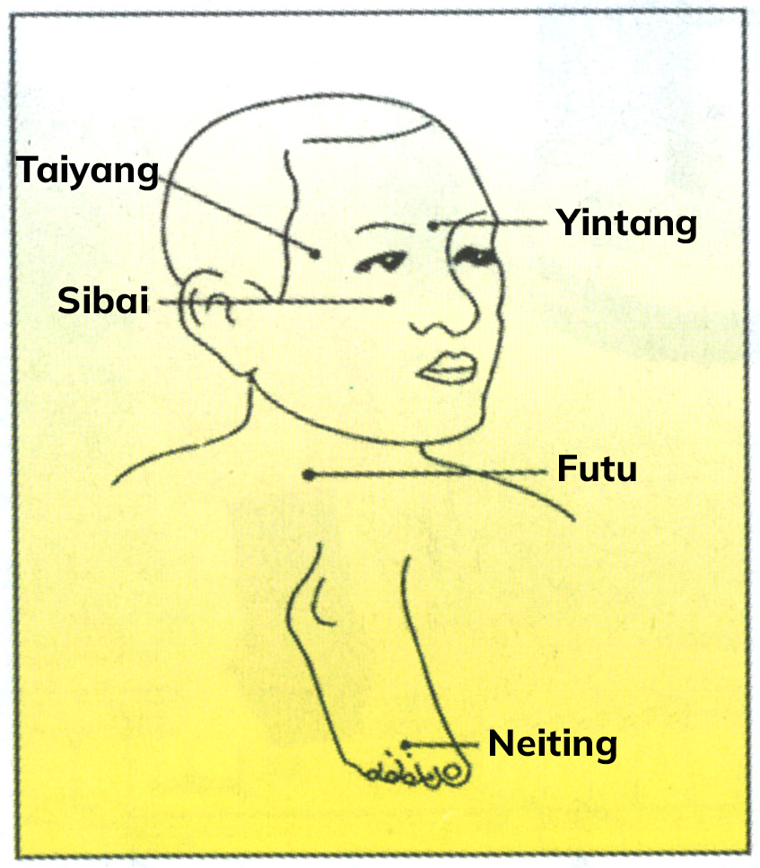 akupunkturne točke