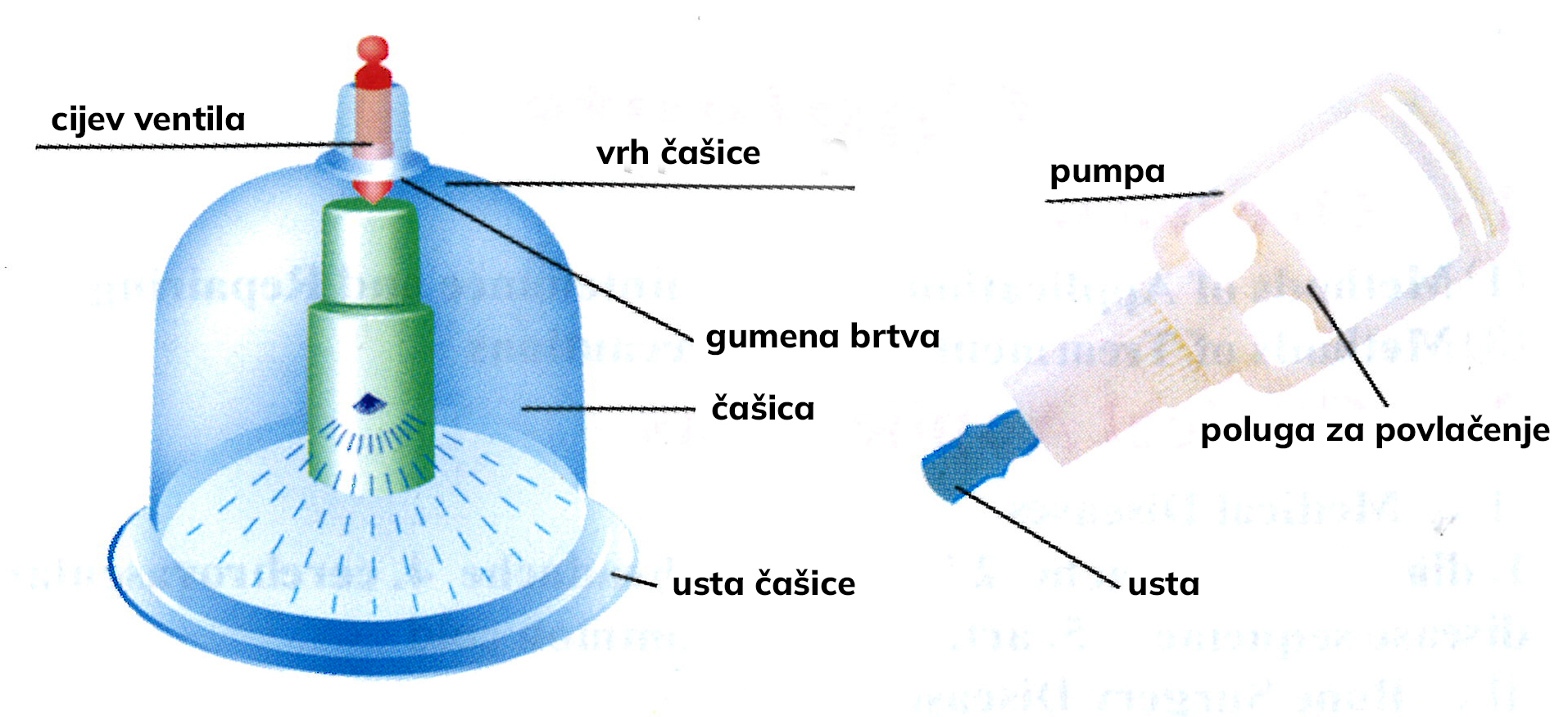 čašica za cupping, dijelovi